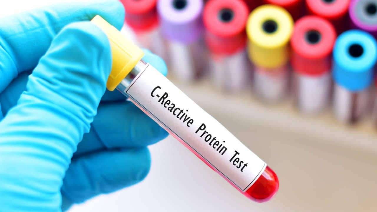 Proteína C reactiva